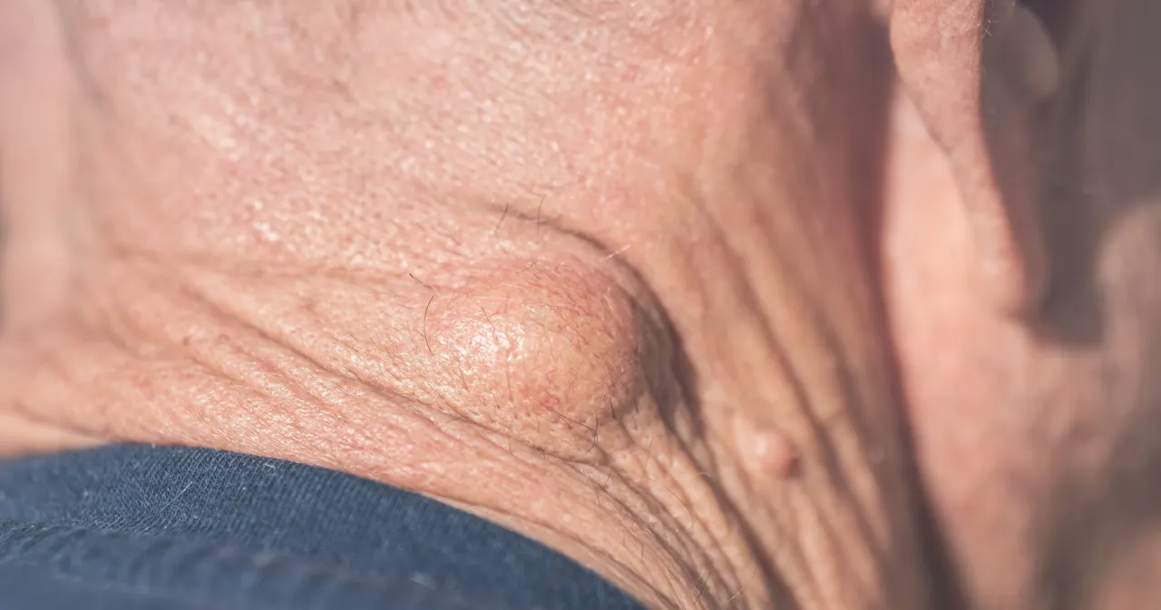 skóra szyi budowa wrażliwość