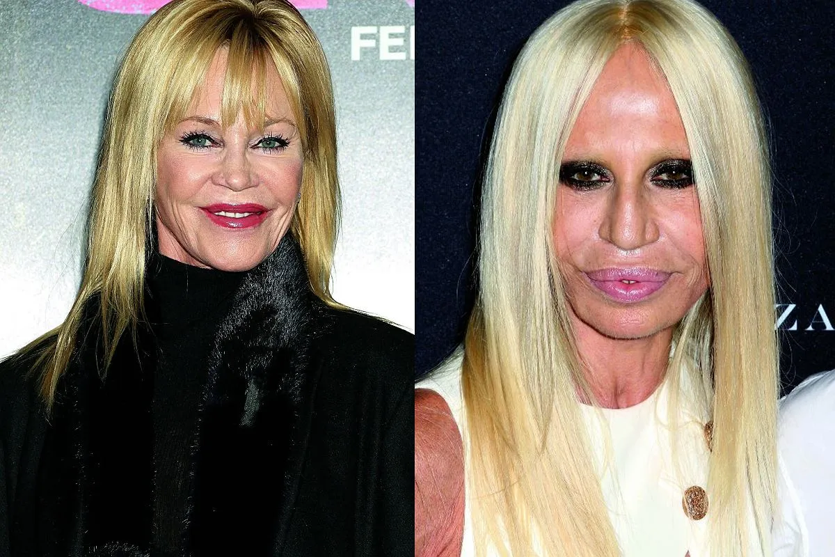 kobieta z powiększonymi ustami delikatnie się uśmiecha