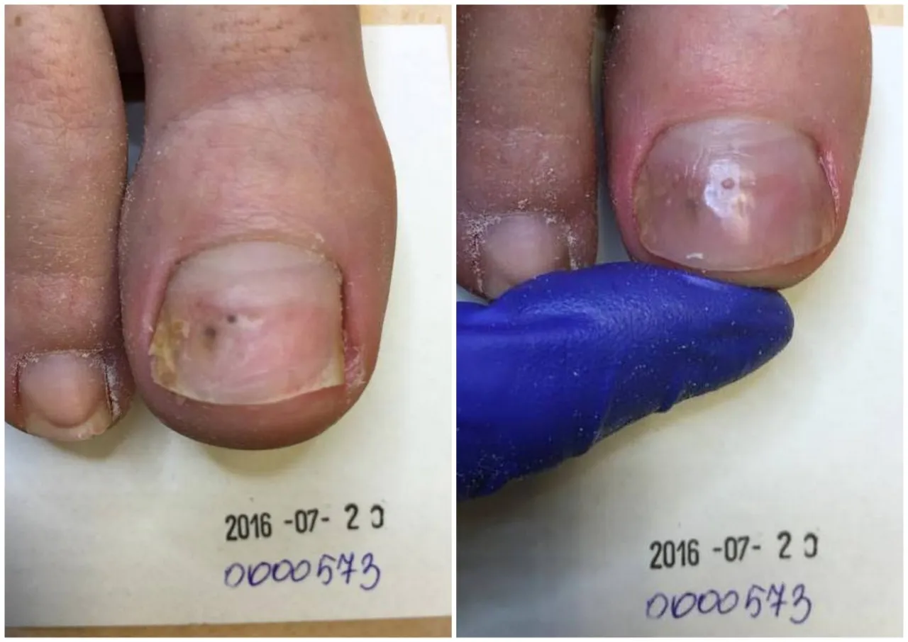 klamry ortonyksyjne kostka arkady