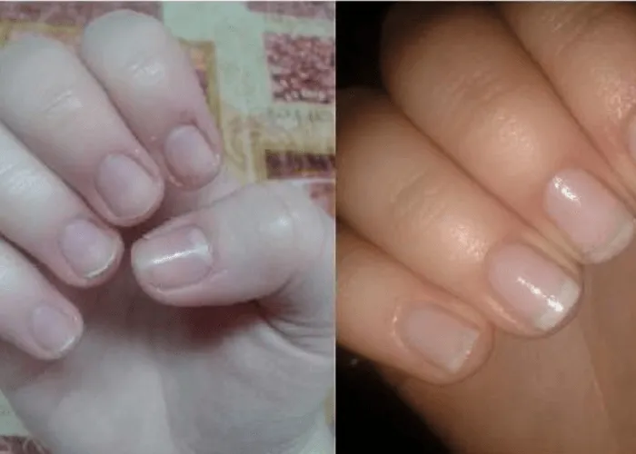 Regenerum lakier do paznokci efekty