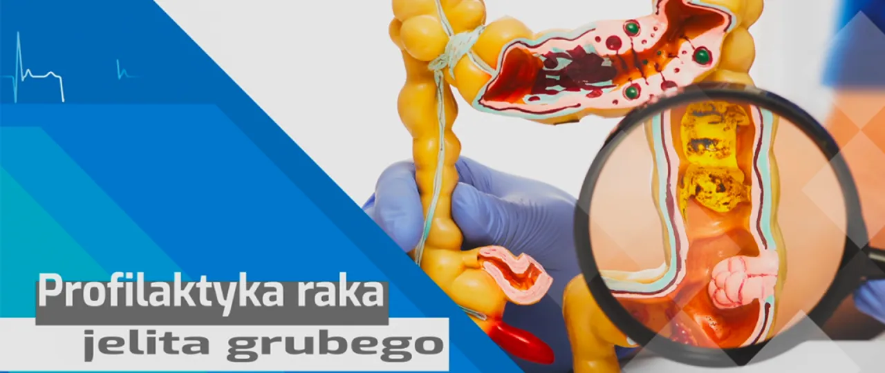 Program Badań Przesiewowych Raka Jelita Grubego kryteria wiekowe