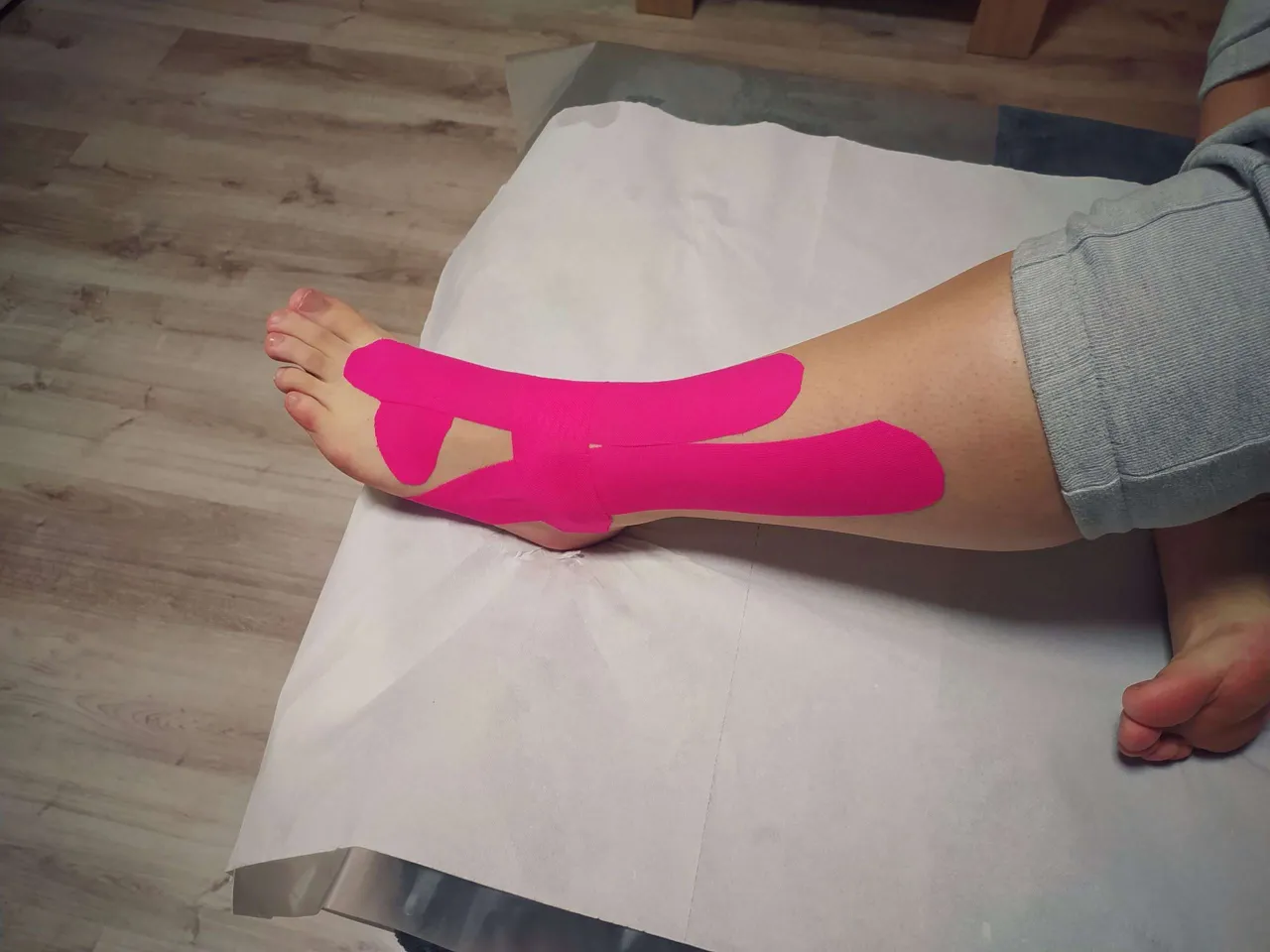 Diagram stopni skręcenia kostki (I, II, III)