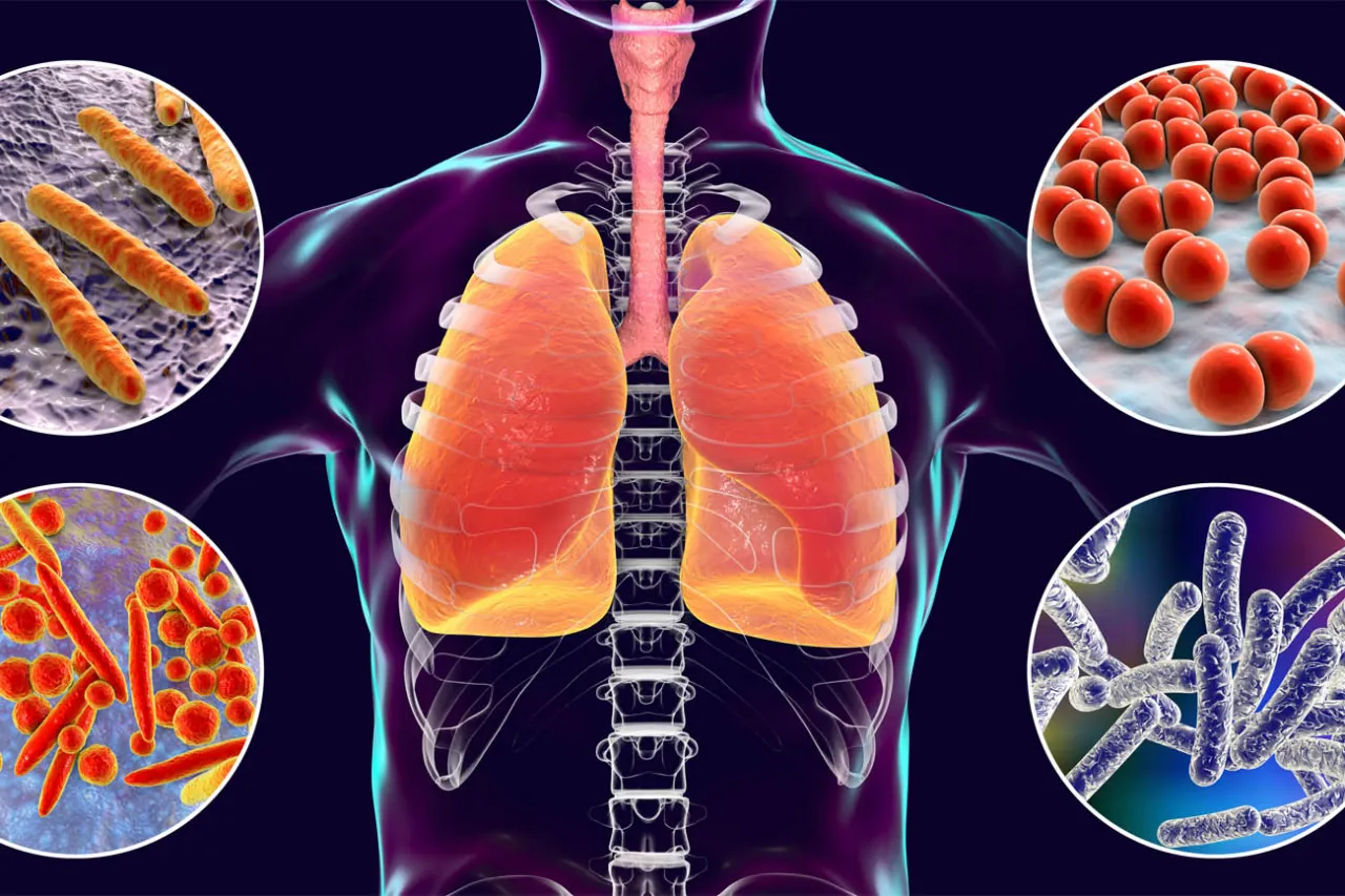 Płuca i drobnoustroje, kt&oacute;re mogą wywołać chorobę legionist&oacute;w. Klimatyzacja może być siedliskiem bakterii.