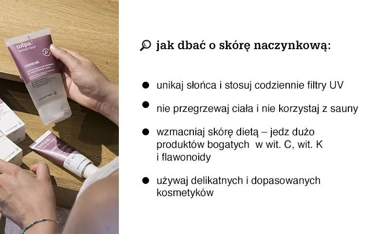 dieta dla cery naczynkowej produkty