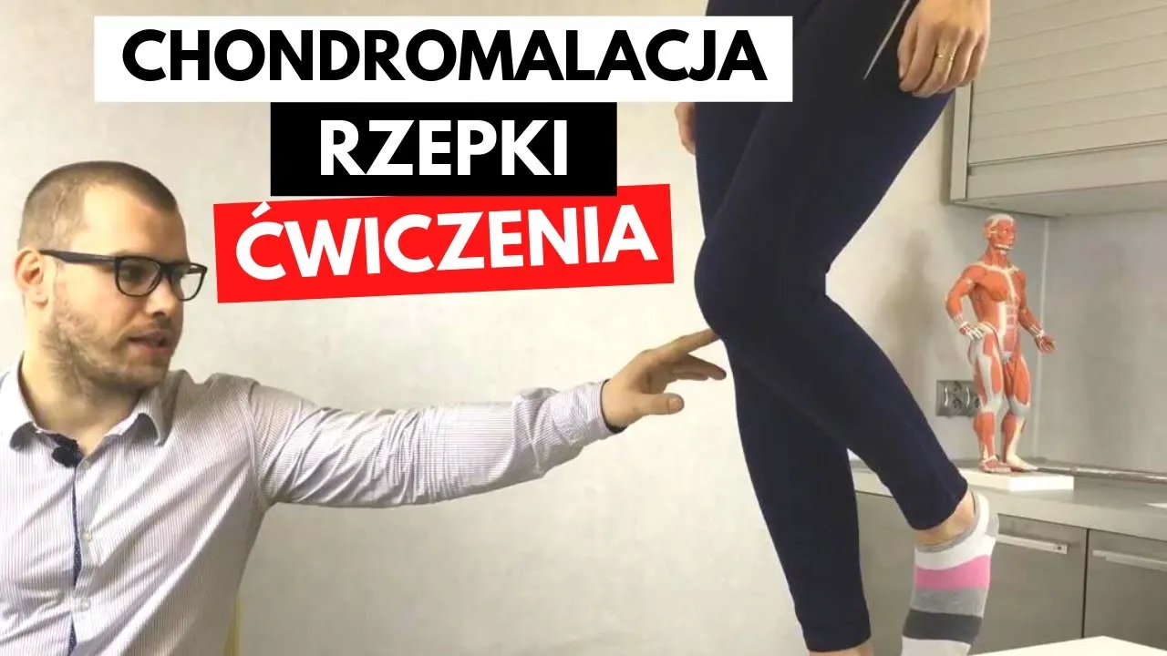Ćwiczenia zakazane chondromalacja rzepki