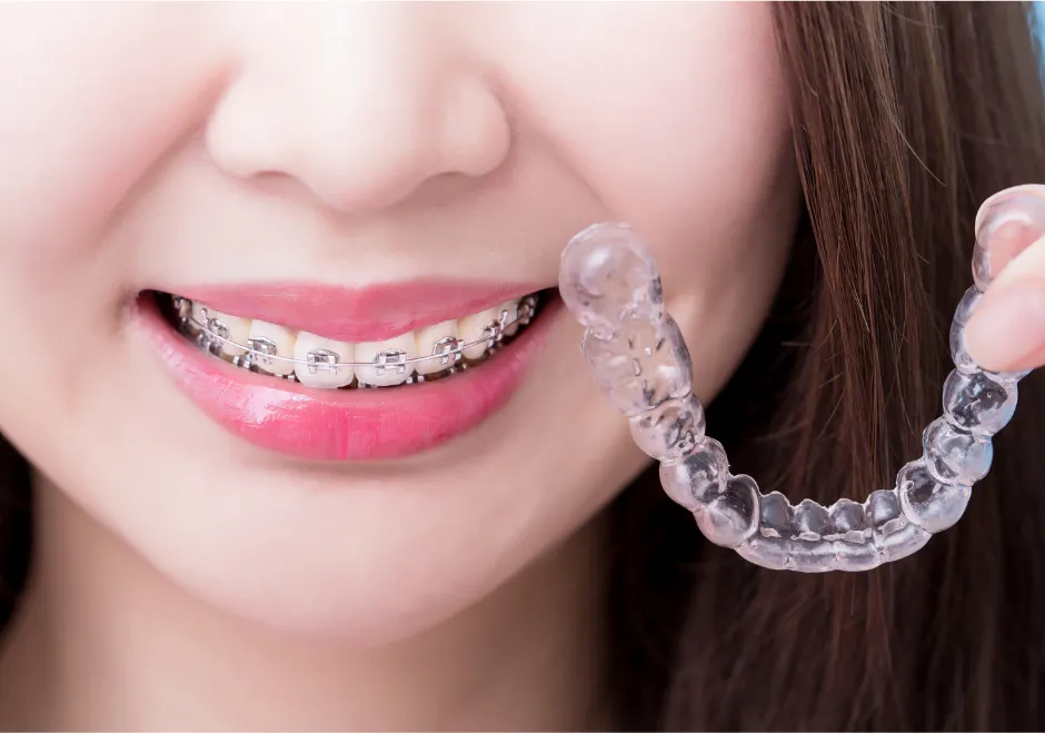 aparat ortodontyczny stały i nakładki