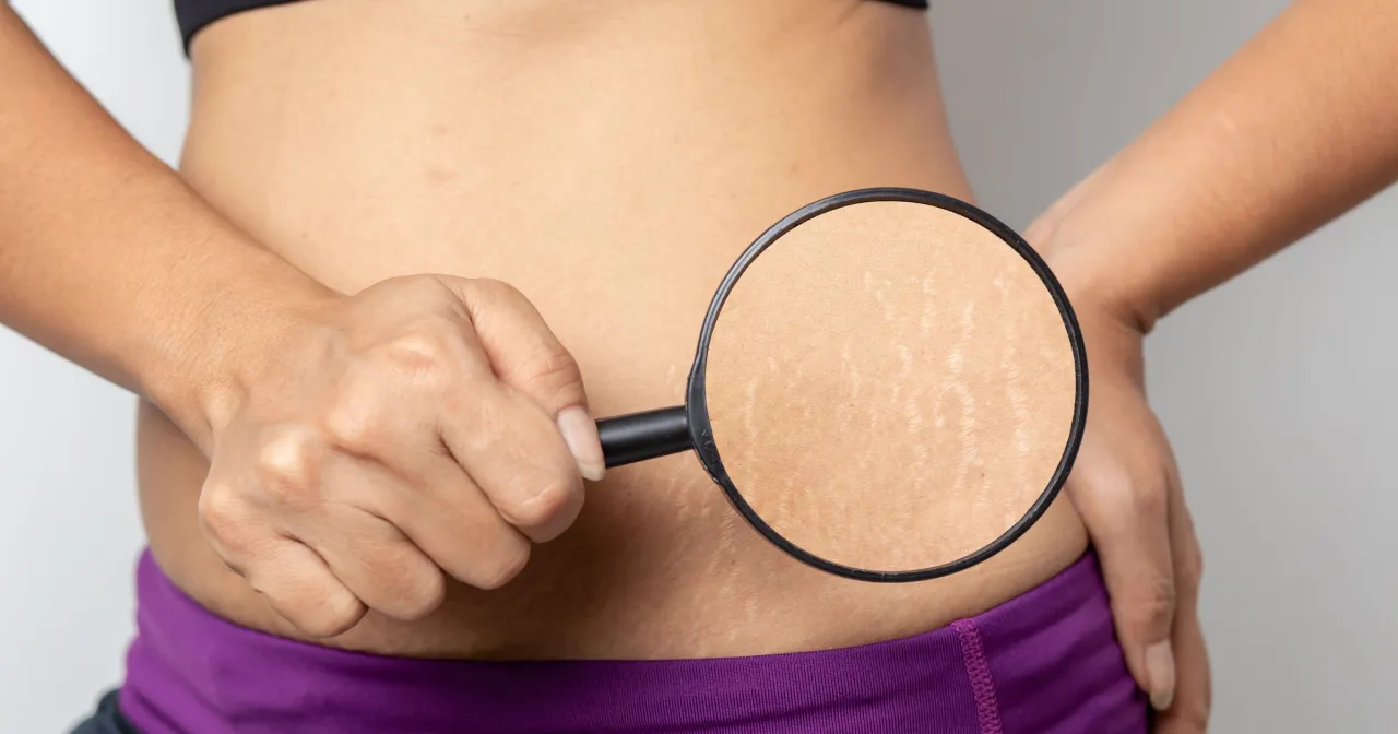 Dieta na elastyczną skórę