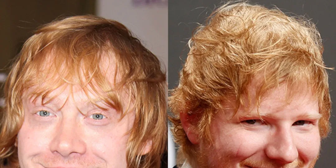 Zdjęcie Czy Ed Sheeran grał w Harrym Potterze? Prawda o plotkach i spekulacjach