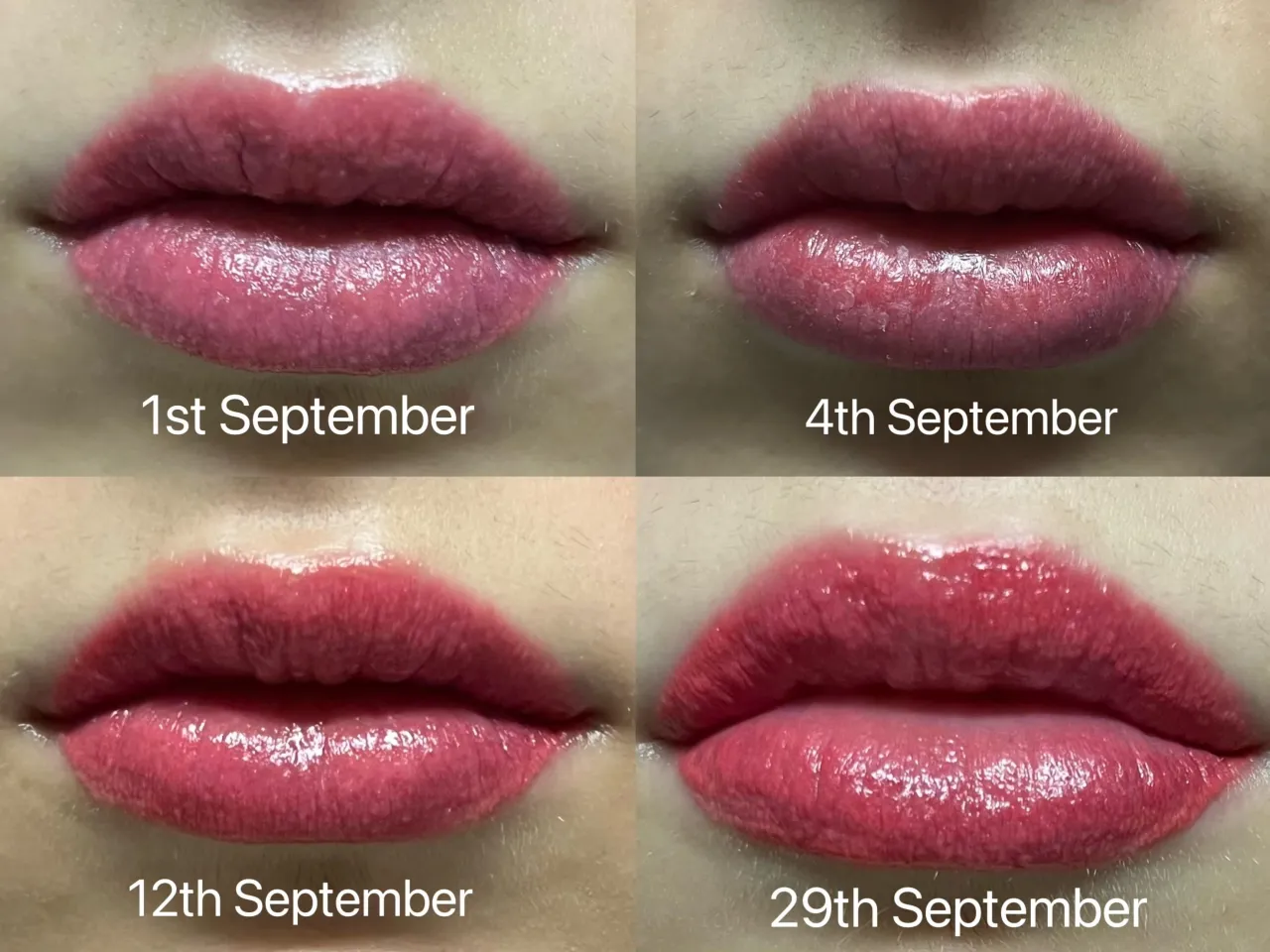 Permanent Make-up Lippen direkt nach Behandlung Schwellung Farbe