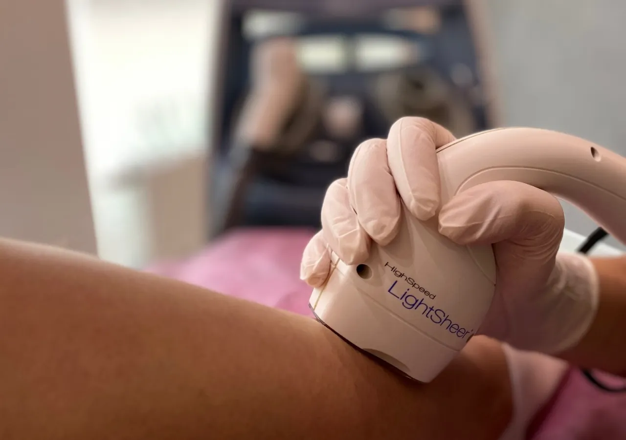 Mapa ciała z zaznaczonymi strefami wrażliwymi na ból podczas depilacji laserowej