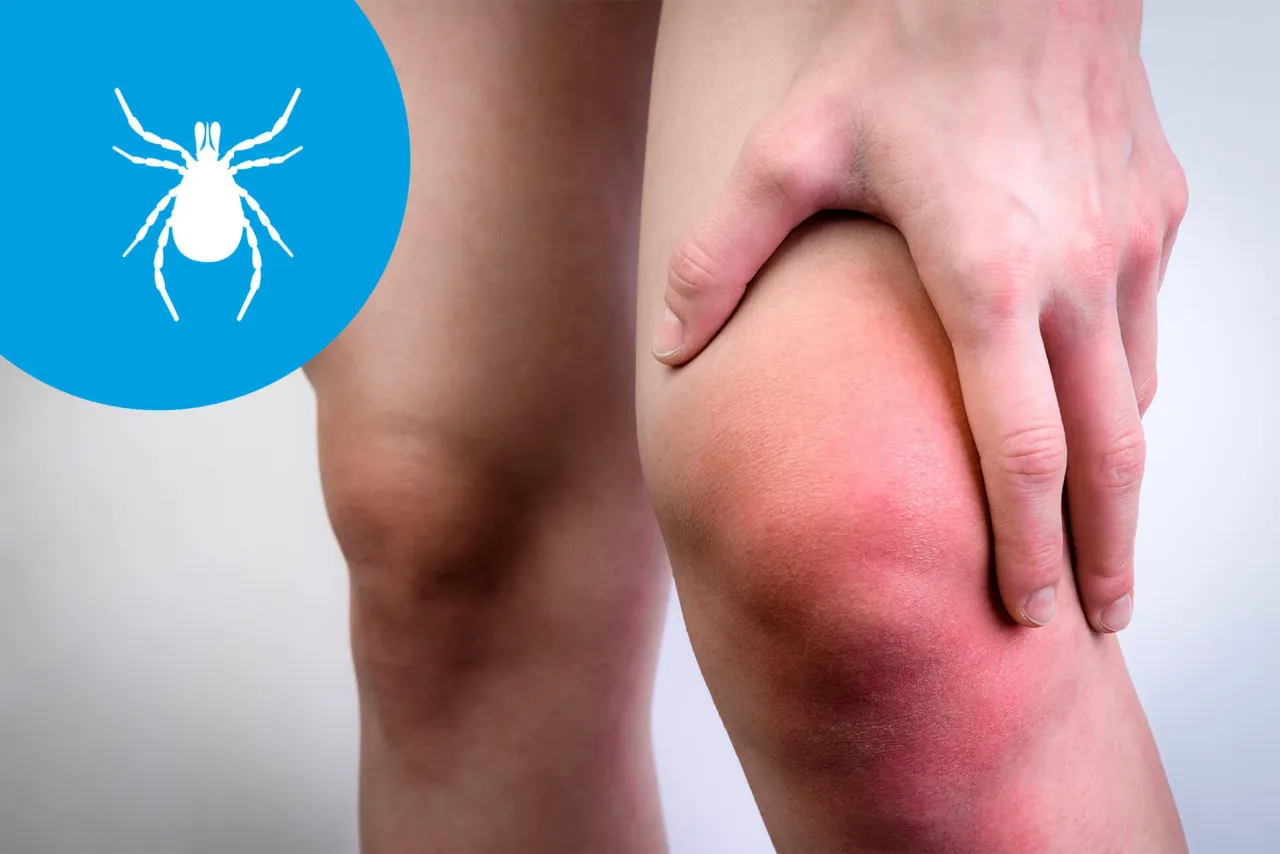 Badania krwi na b&oacute;l mięśni, diagnostyka mialgii