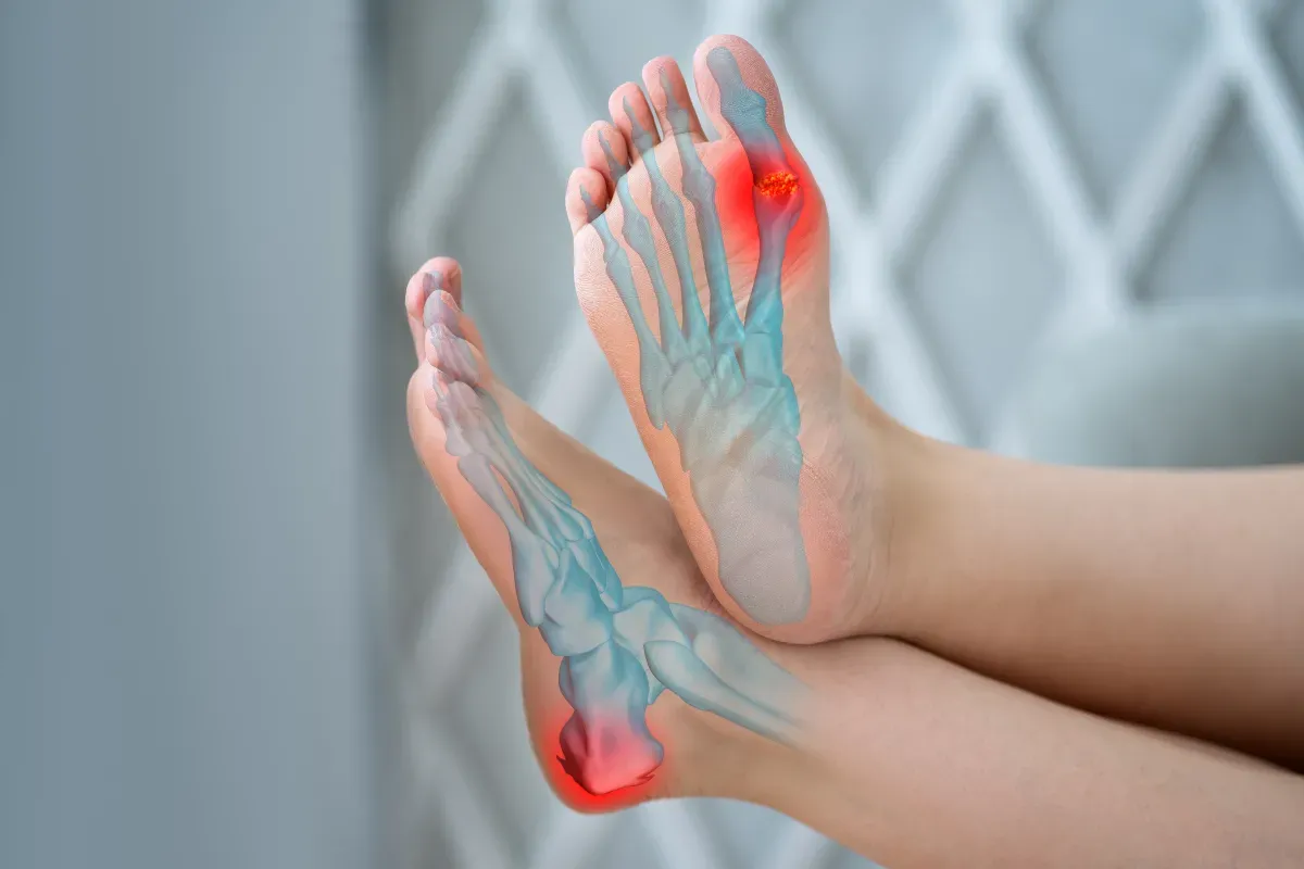 Dieta w dnie moczanowej produkty zakazane