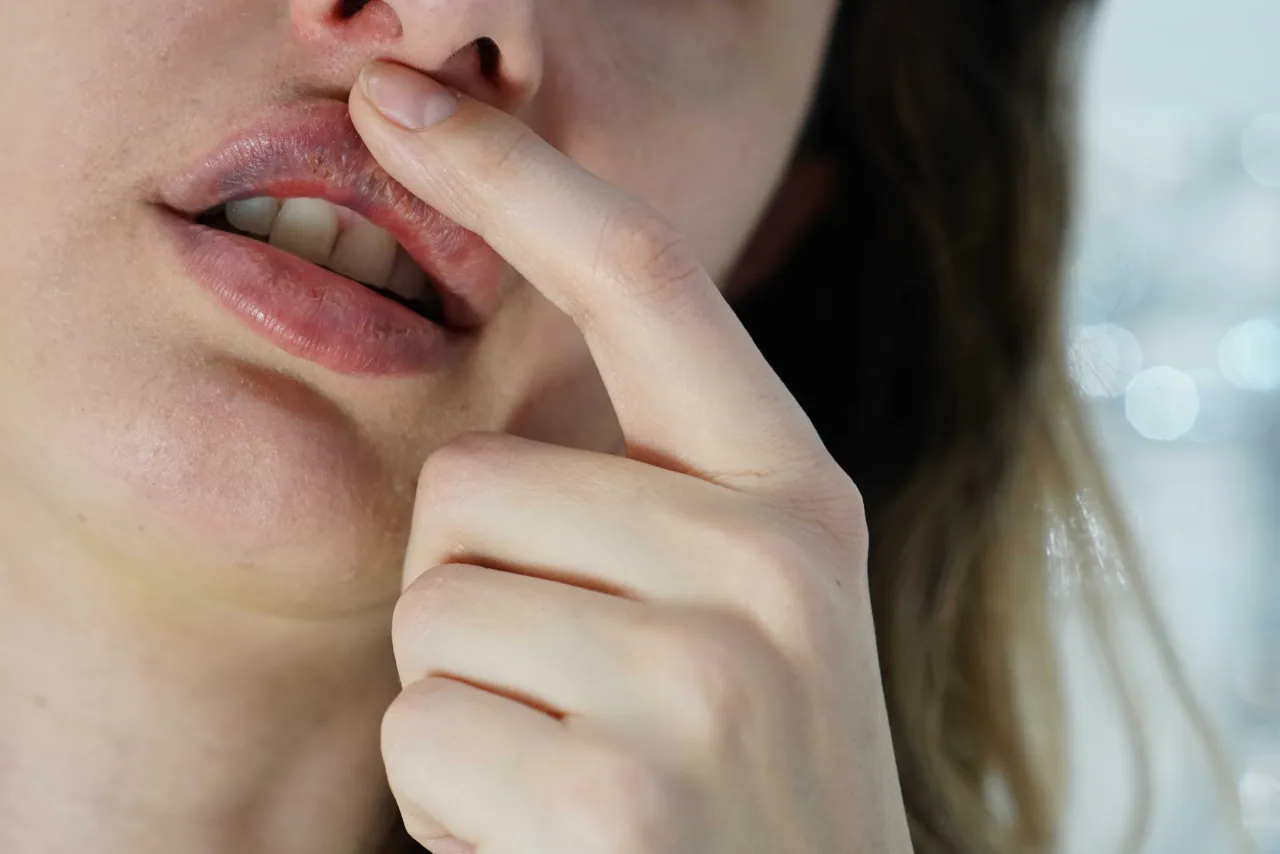 Usta z pękniętą skórką i zaczerwienieniem, dotykane palcem. Czy kwas hialuronowy uczula?