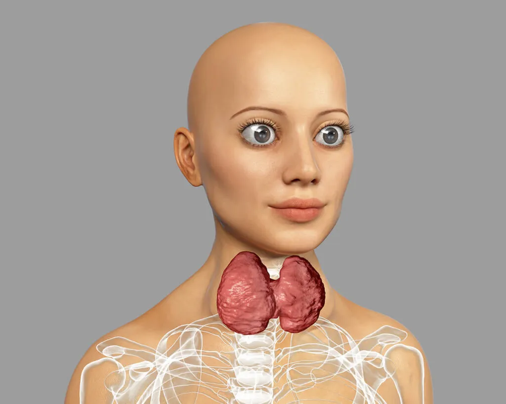 objawy wytrzeszcz oczu choroba Gravesa-Basedowa