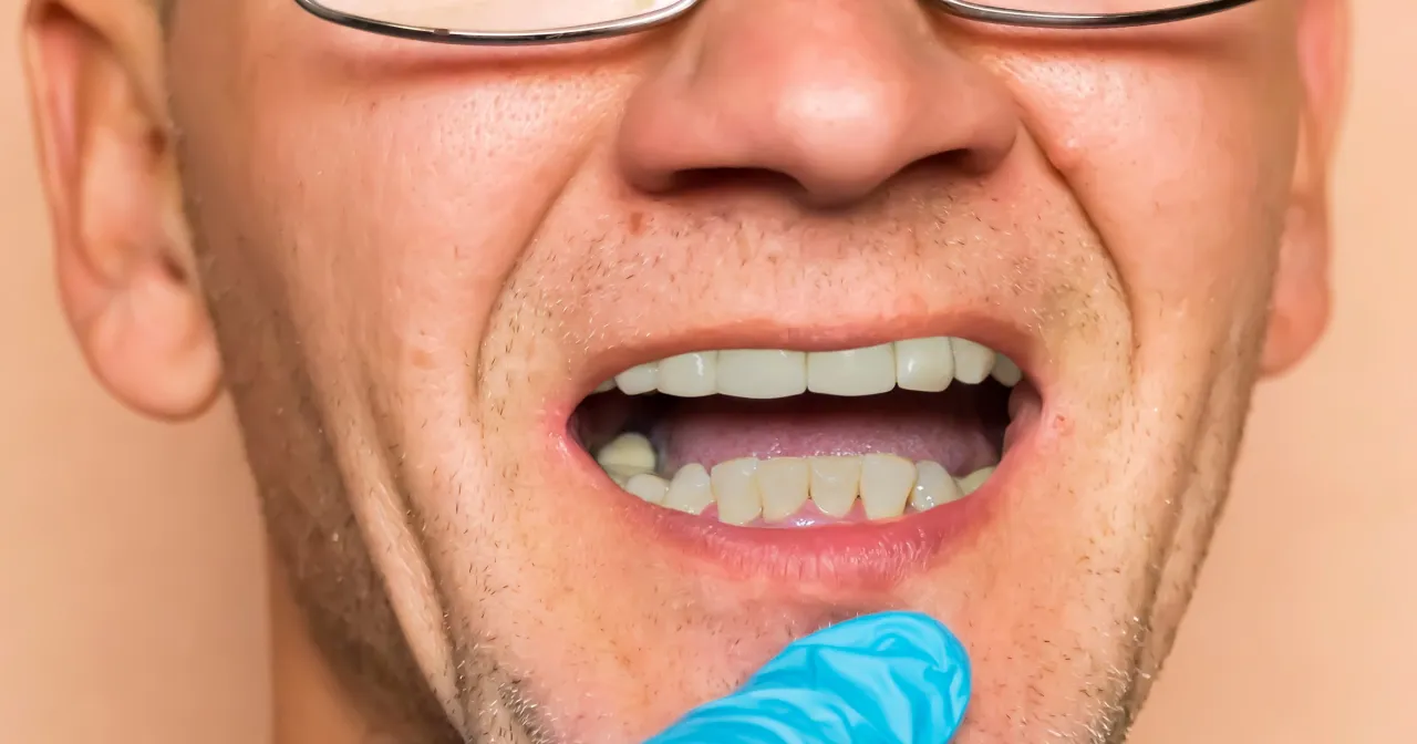 przyczyny osłabienia zębów