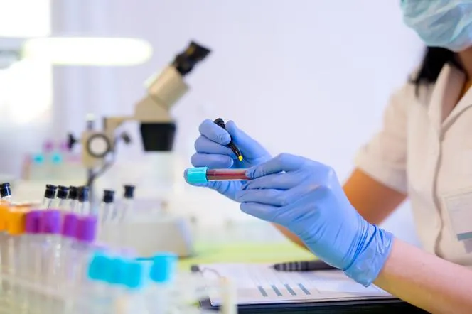 Zdjęcie Badania serologiczne – co to jest i jakie mają zastosowanie w diagnostyce
