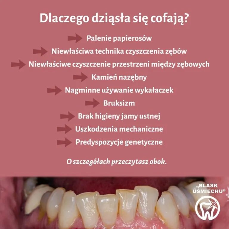 Zdjęcie Dlaczego dziąsła się cofają? Przyczyny, objawy i skuteczne sposoby leczenia
