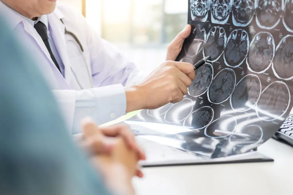 Zdjęcie Neurochirurg kto to: kluczowe informacje o jego roli i specjalizacji