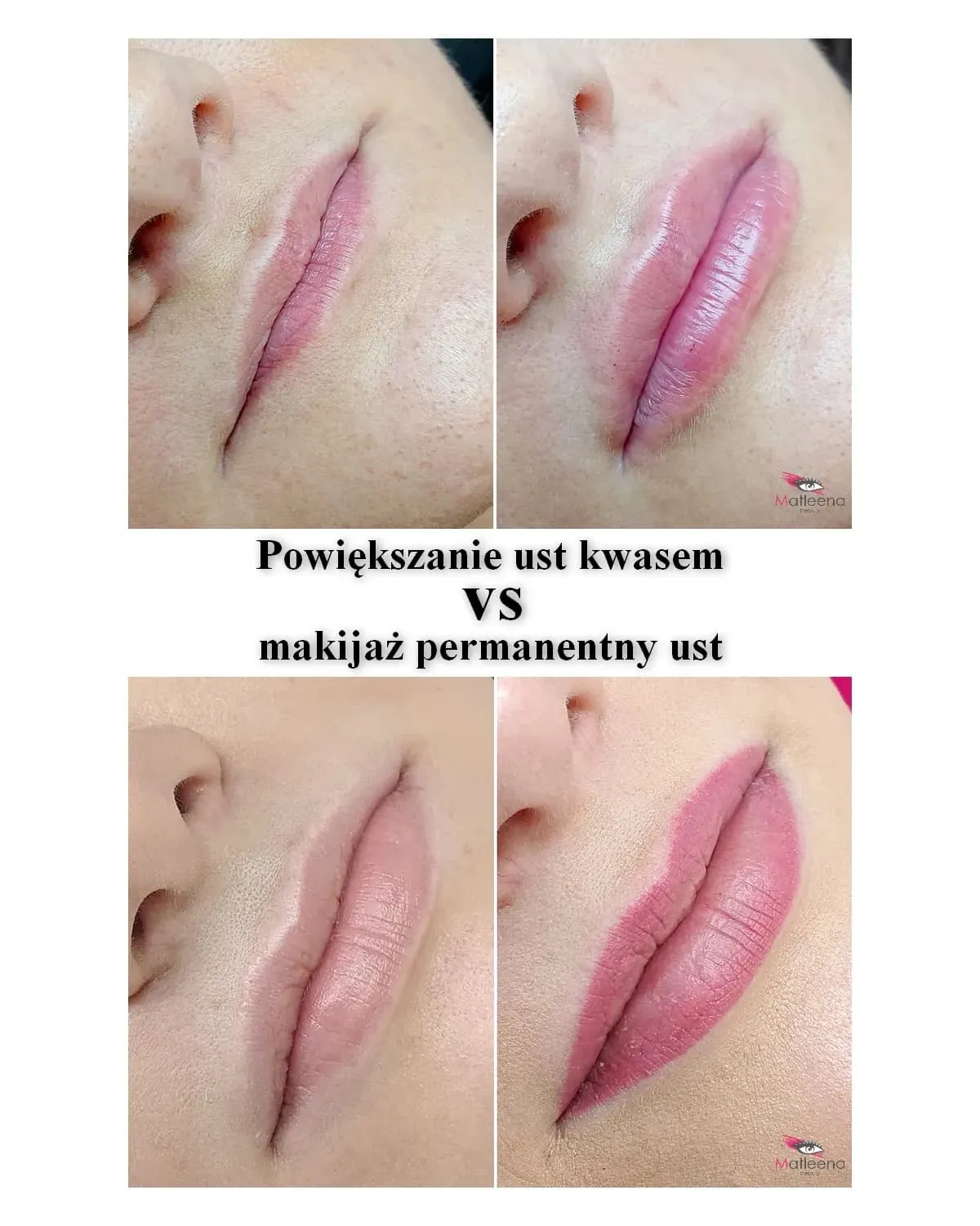 Zdjęcie Jak wyglądają usta po makijażu permanentnym? Efekty i zmiany po zabiegu