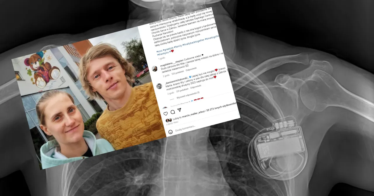 Zdjęcie Na co choruje żona kubackiego: poznaj prawdę o jej poważnej chorobie serca