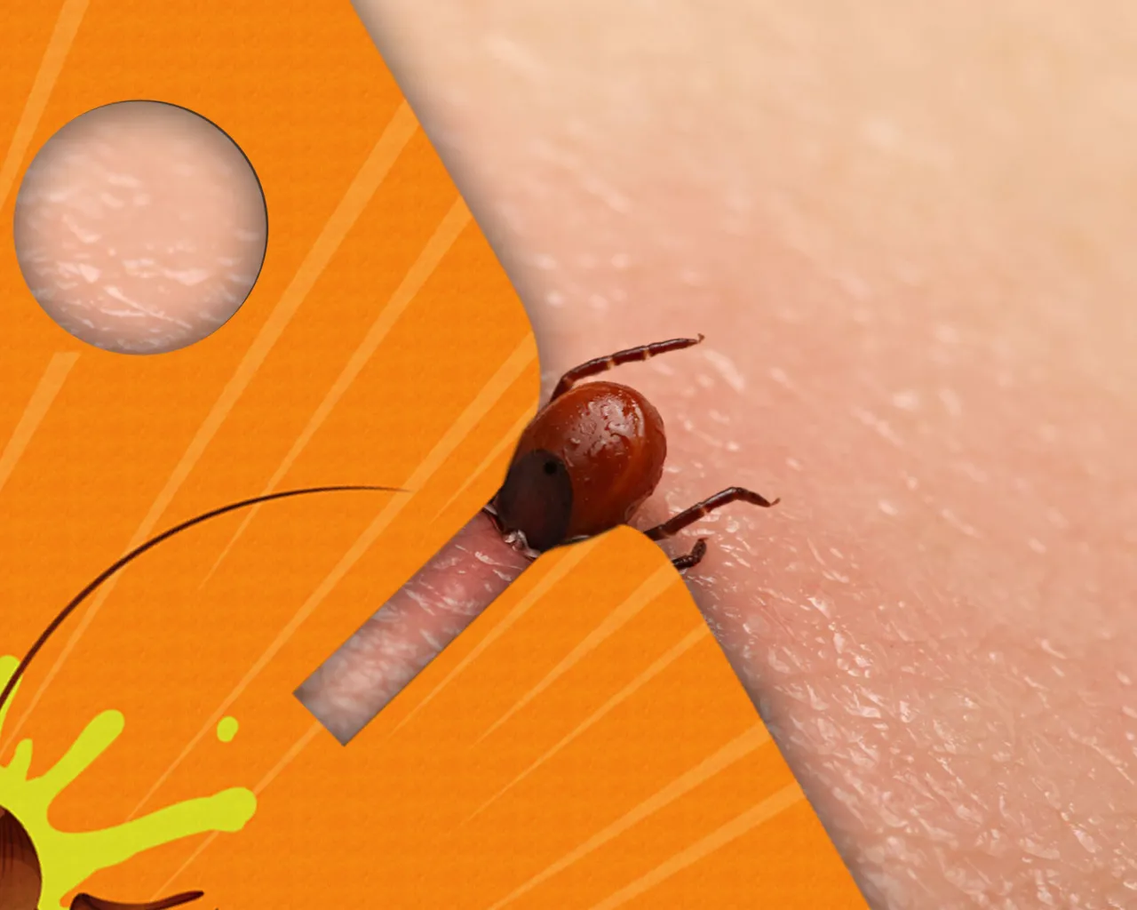 narzędzia do usuwania kleszczy pęseta kleszczołapki karta