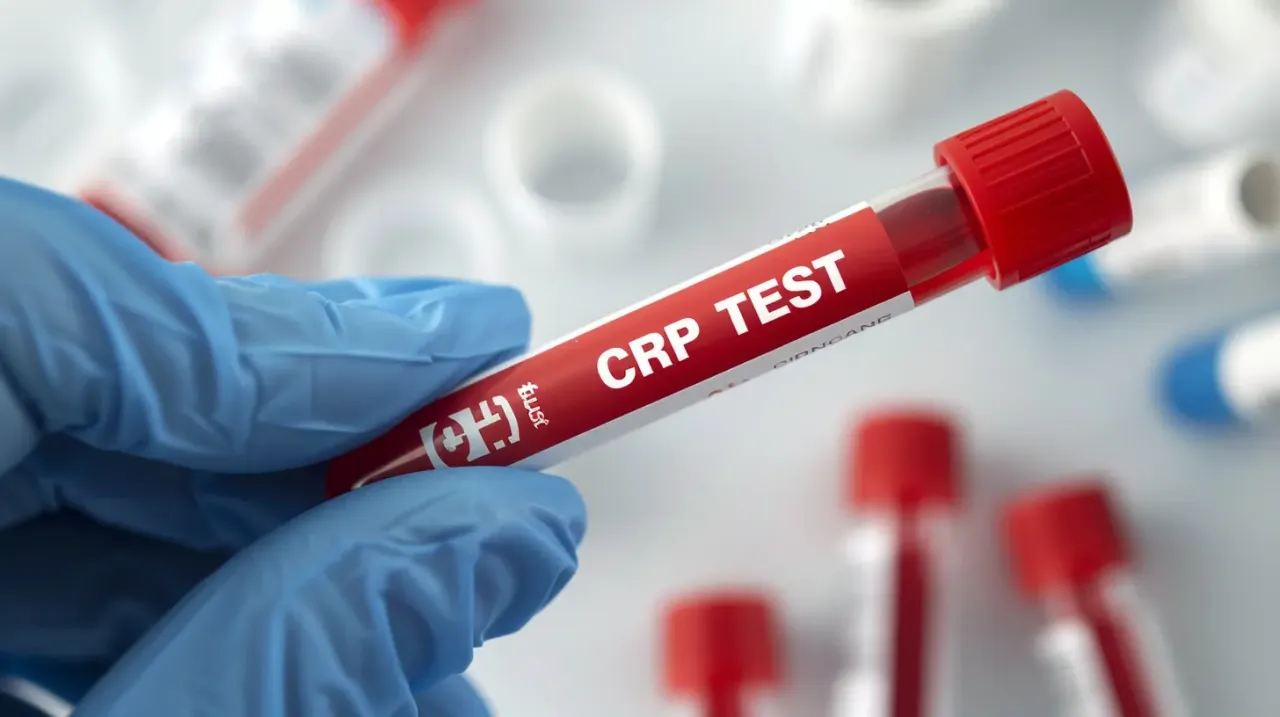 Wykres słupkowy przyczyn wysokiego CRP