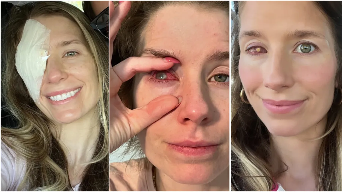 kobieta płacząca w soczewkach kontaktowych