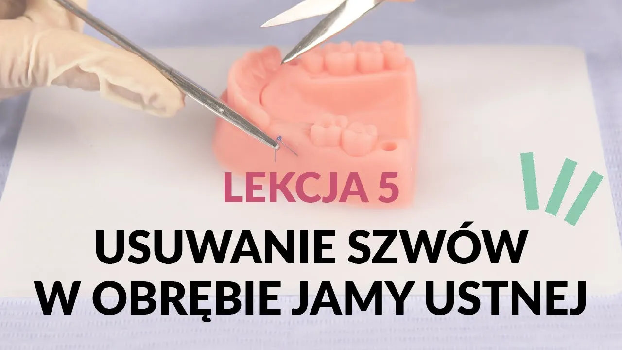 dentysta usuwanie szw&oacute;w z dziąsła