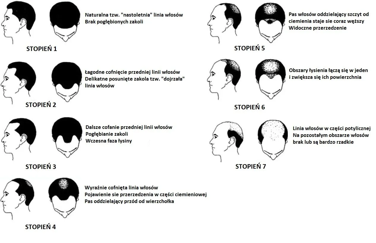 Łysienie androgenowe schemat, cykl życia włosa grafika