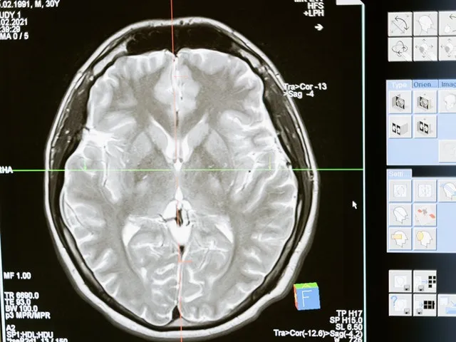Mózg osoby uzależnionej od alkoholu