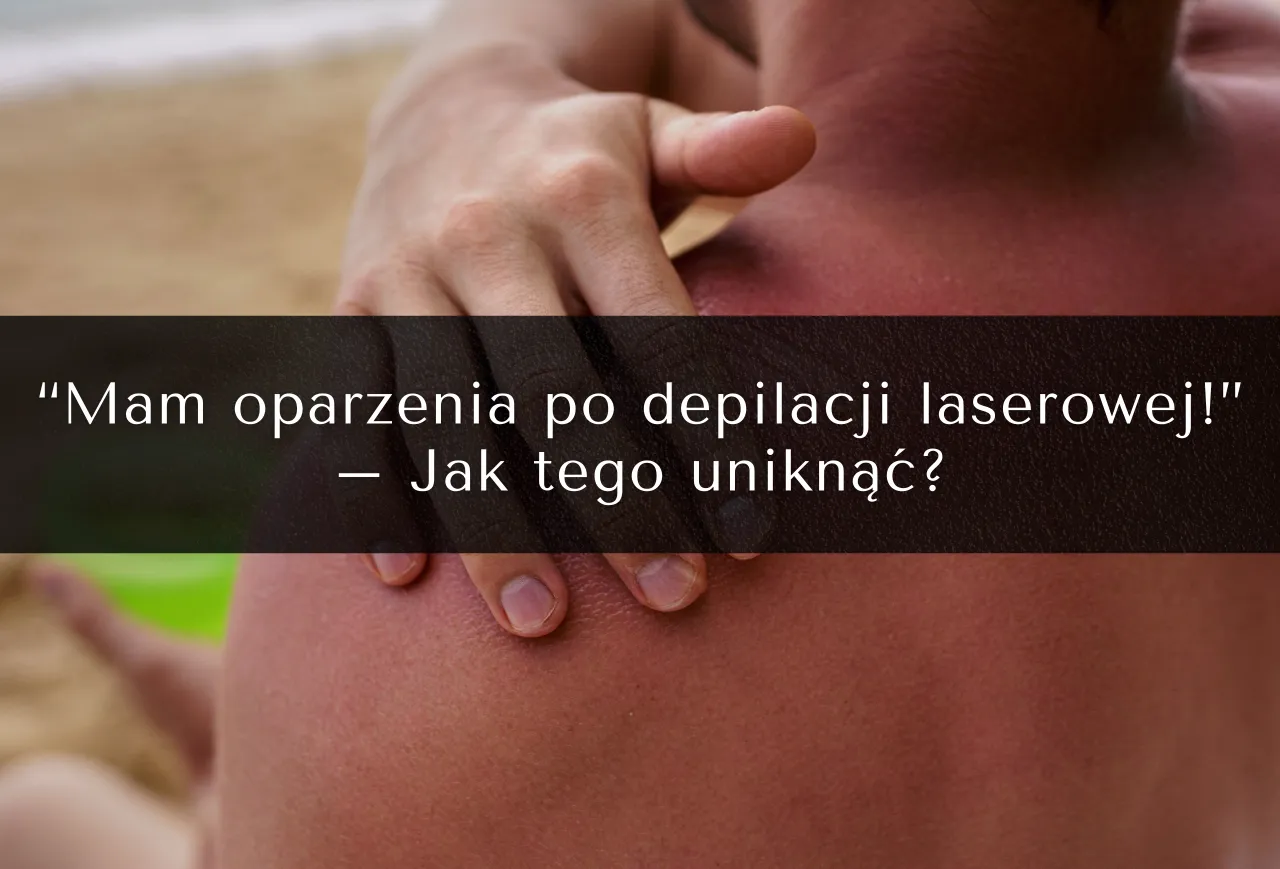 Skutki opalania po depilacji laserowej, przebarwienia, poparzenia skóry