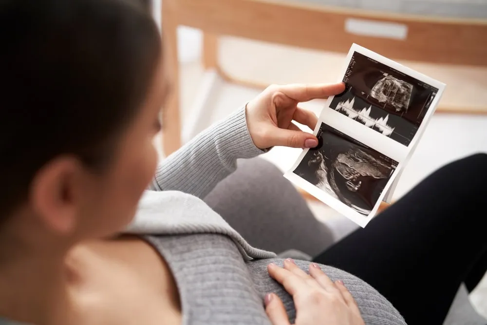 Zdjęcie Jak zachowuje się płód z zespołem downa? Cechy i wskaźniki rozwoju