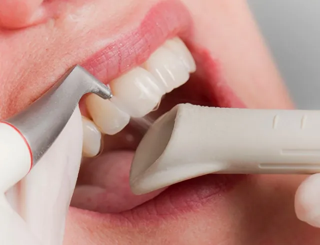 Dentysta wykonujący skaling i piaskowanie zębów