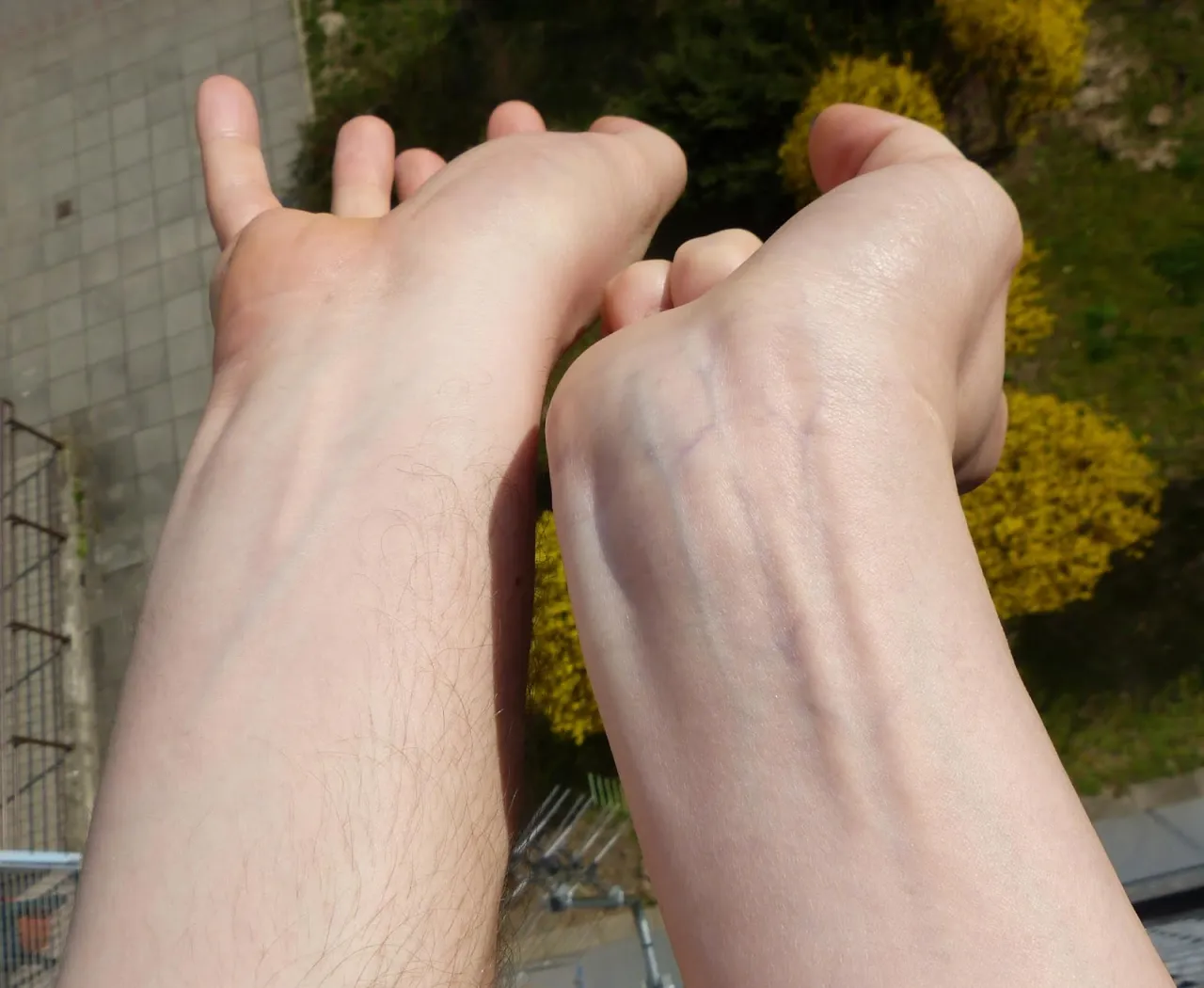 test żył nadgarstek tonacja skóry