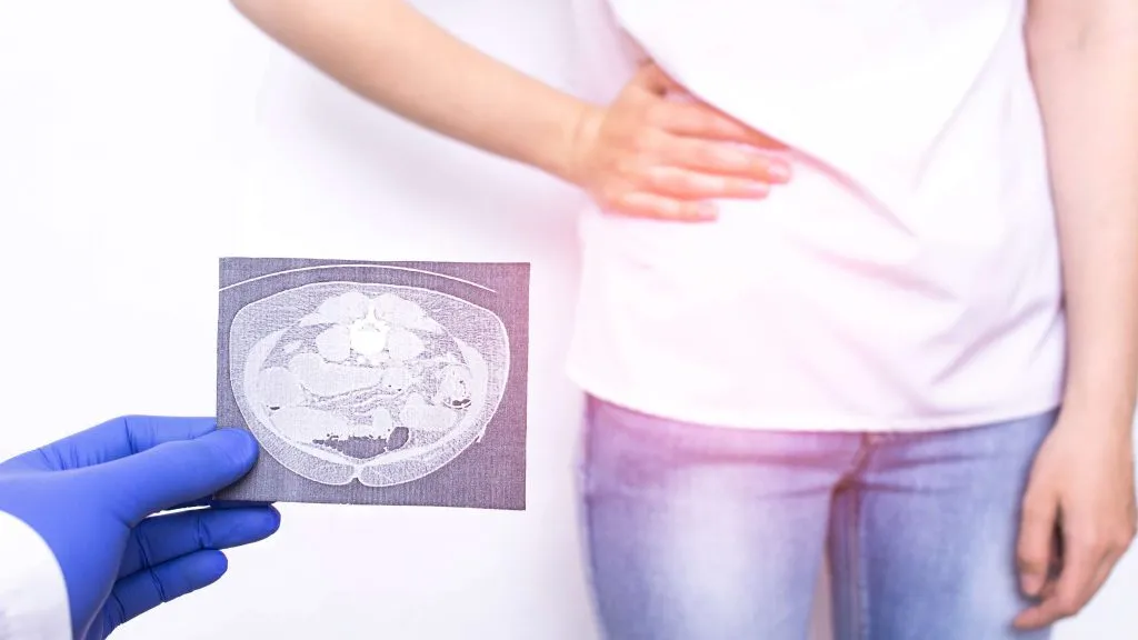 Zdjęcie Jakie badania na wyrostek — kluczowe informacje o diagnostyce zapalenia.