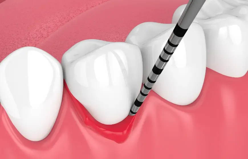 szynowanie zęb&oacute;w tymczasowe i stałe