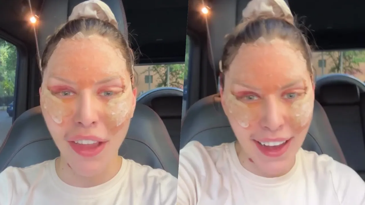 Kobieta unika słońca po zabiegu na twarz