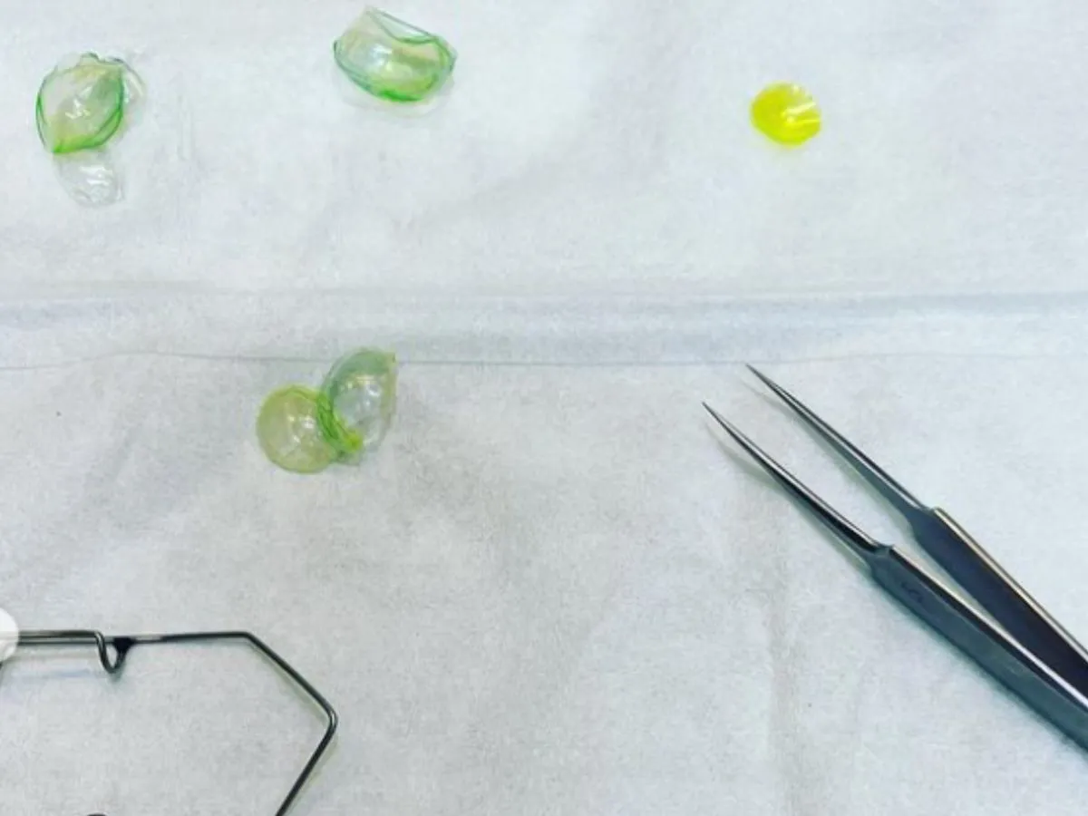 niebezpieczne zamienniki płynu do soczewek