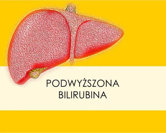 schemat diagnostyki podwyższonej bilirubiny