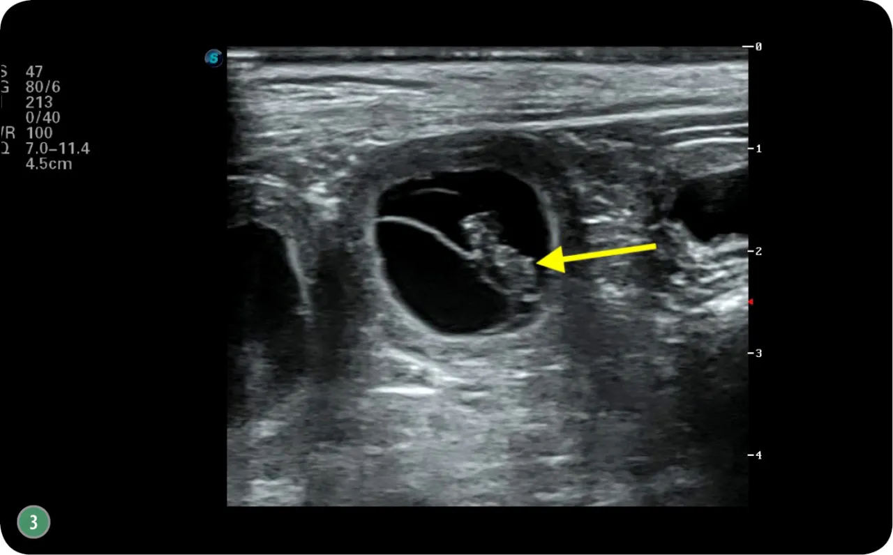 USG ciąży u kotki, RTG kociąt przed porodem