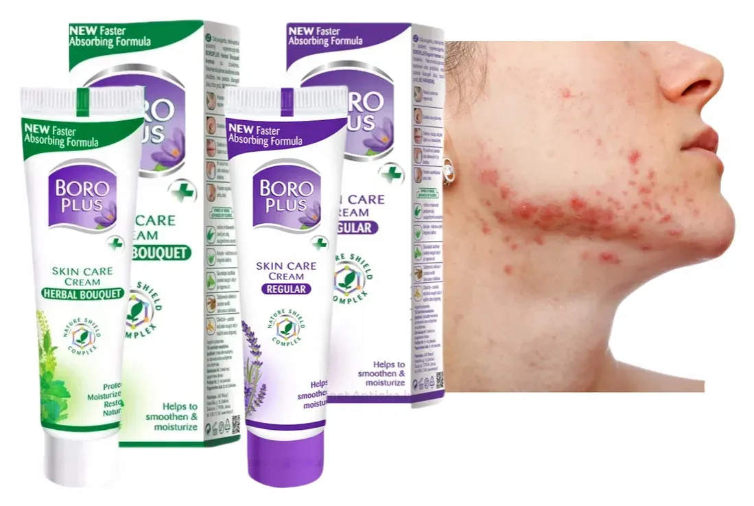 rodzaje krem&oacute;w na trądzik konsystencje