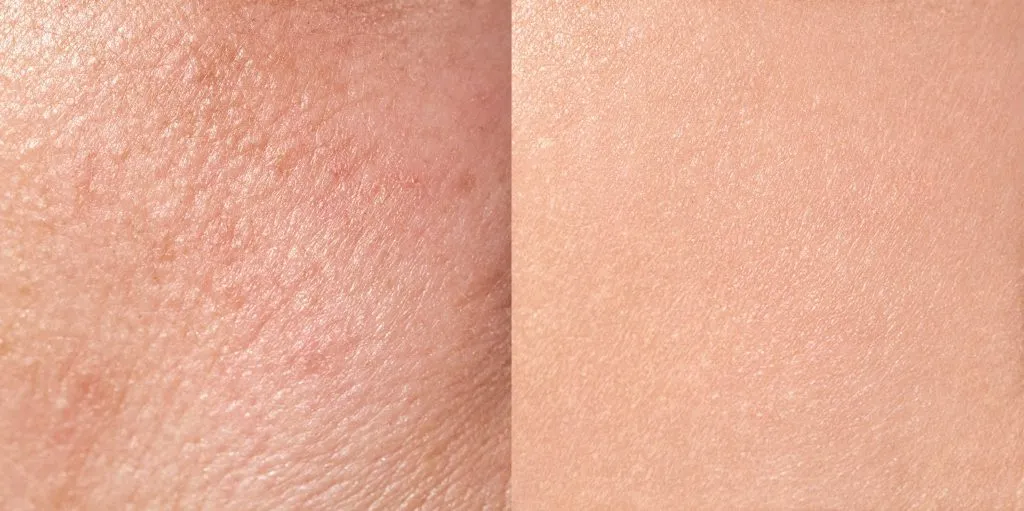 cera sucha vs odwodniona