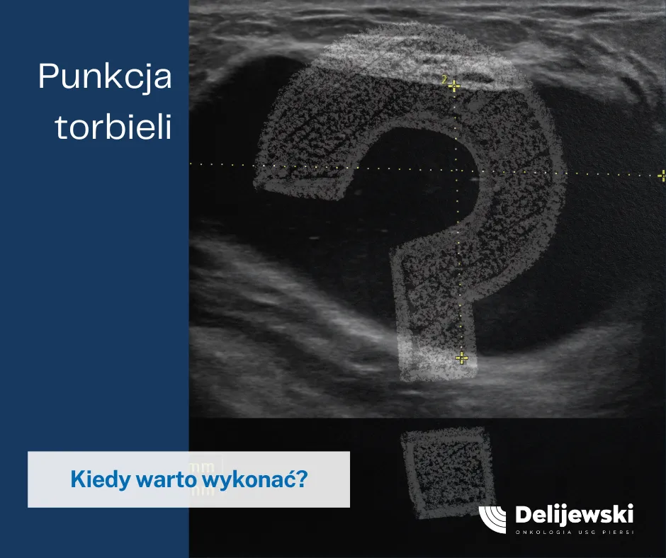 Zdjęcie Biopsja torbieli w piersiach - czy naprawdę boli i co musisz wiedzieć?