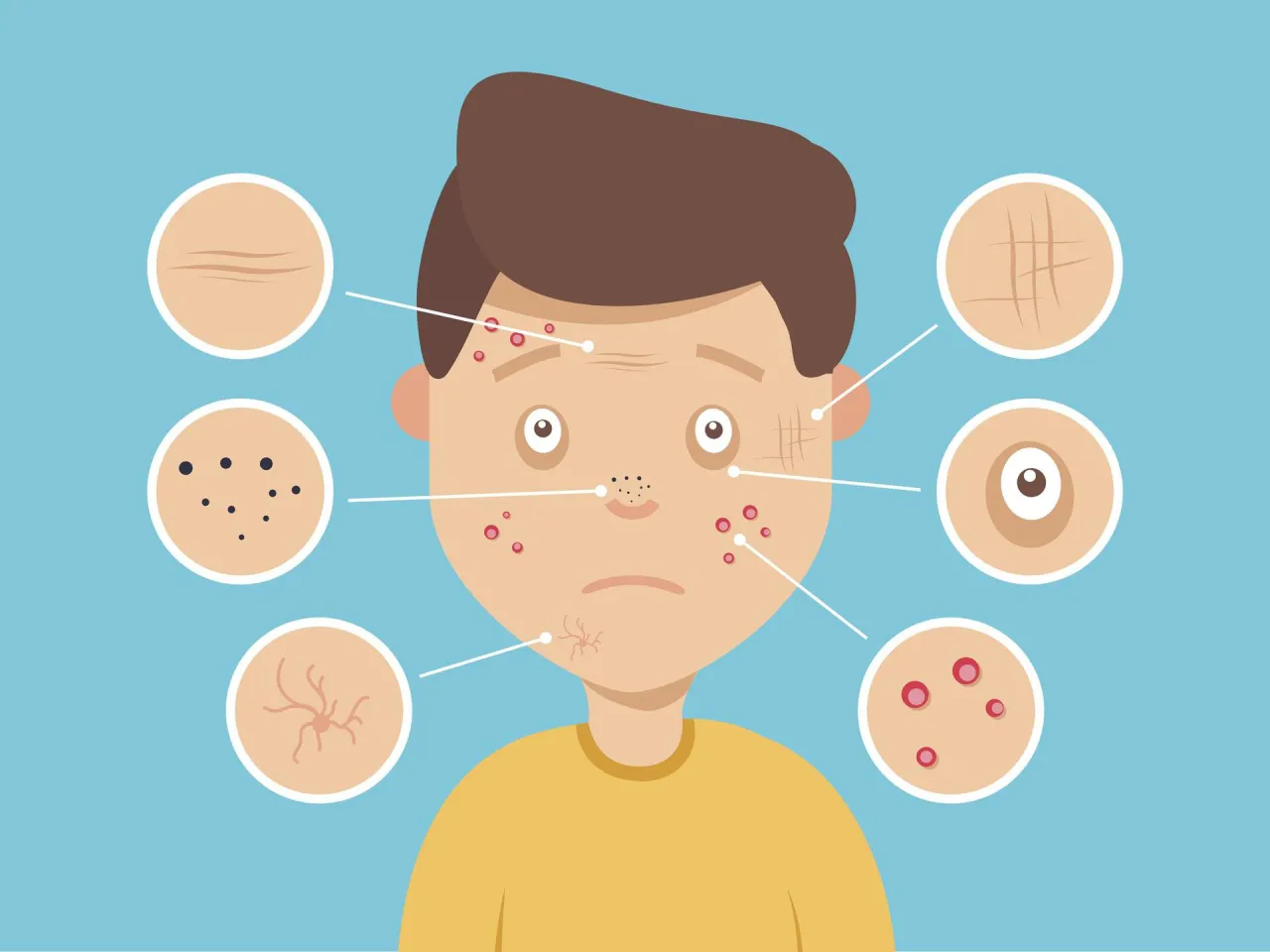 skuteczne preparaty na pryszcze bez recepty