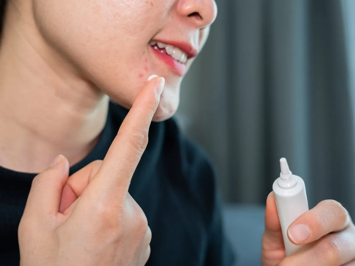 Przekreślona pasta do zębów i dłoń wyciskająca pryszcza