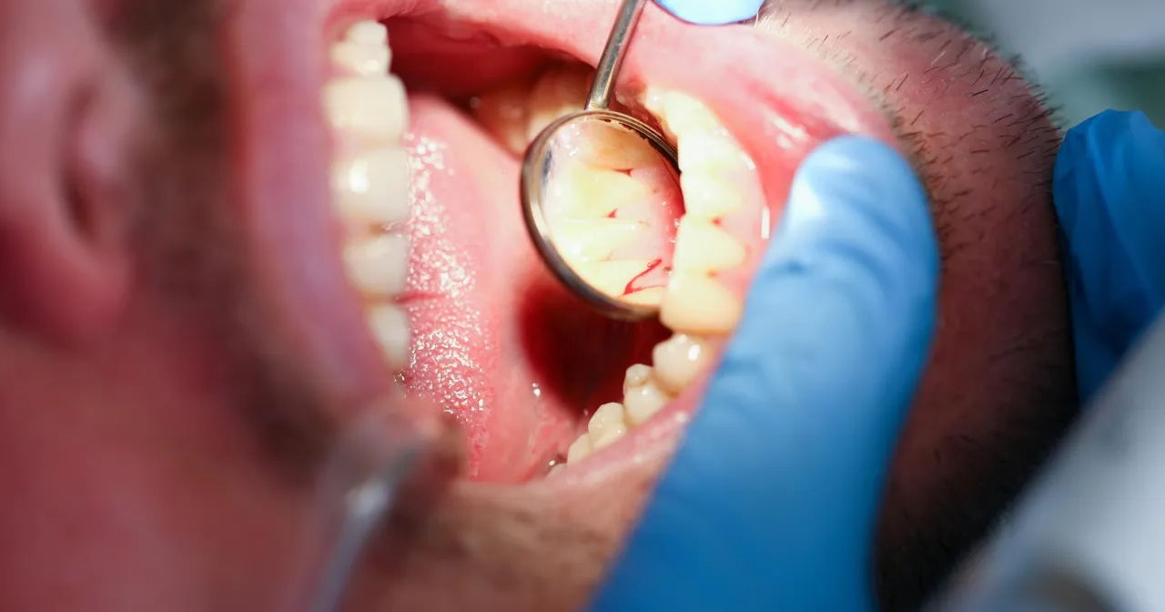 Przyczyny bólu dziąseł grafika