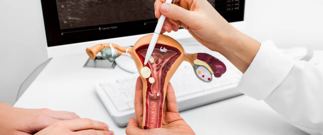 anatomia macicy bolesne miesiączki