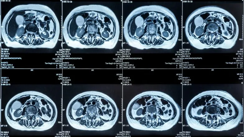 por&oacute;wnanie tomografia rezonans usg trzustki