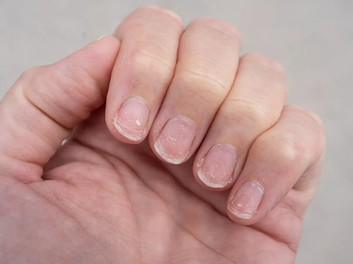 Regeneracja paznokci po hybrydzie domowe sposoby