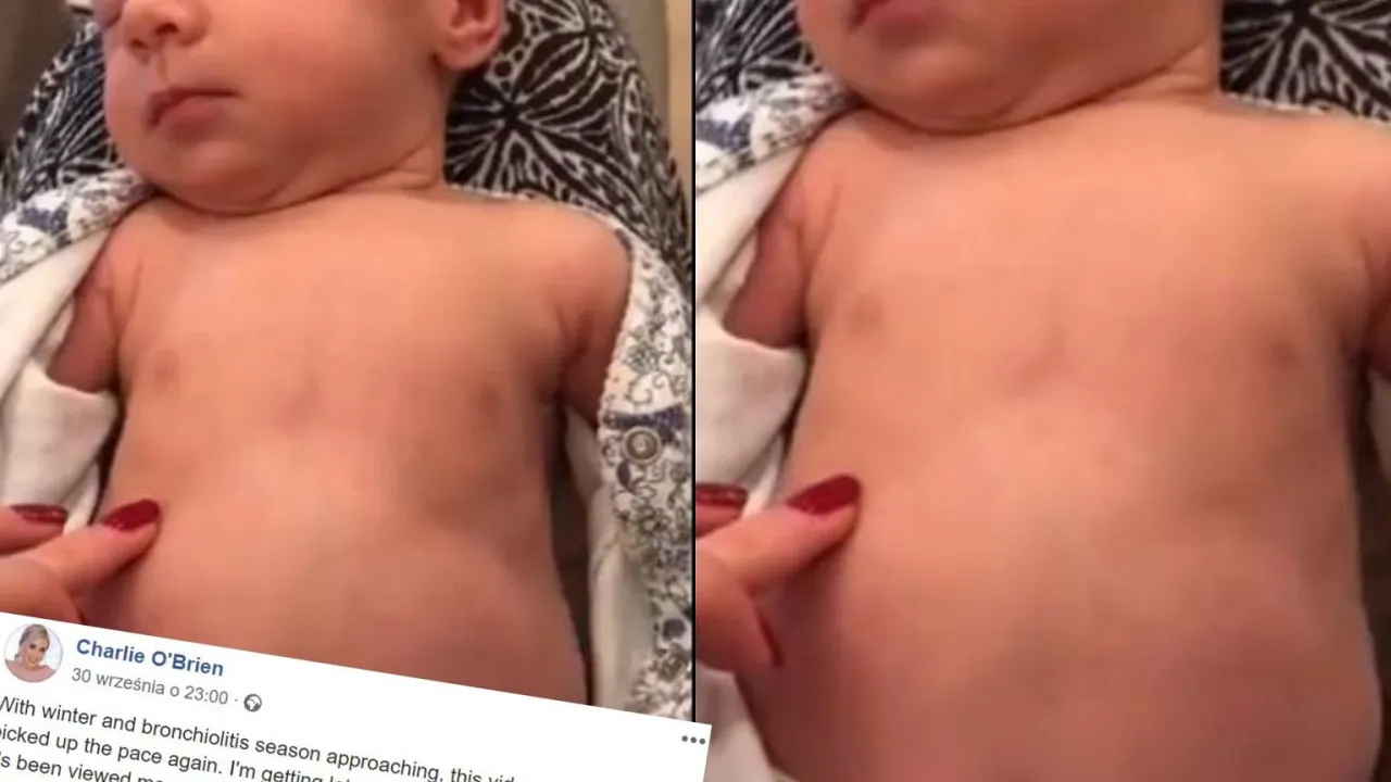 niemowlę trudności z oddychaniem